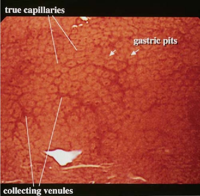 Hình ảnh minh họa các hố dạ dày (Gastric pit)