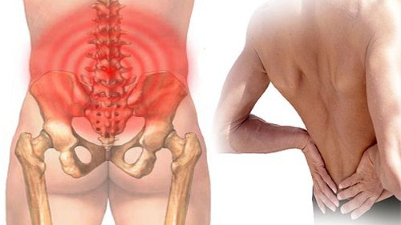 Va chạm vật cứng gây đau lưng là dấu hiệu của bệnh gì?