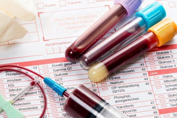 Chỉ số sinh hóa trong các xét nghiệm chẩn đoán viêm loét đại tràng chảy máu