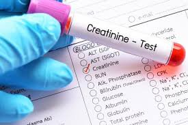 Tại sao kết quả xét nghiệm Creatinin tăng sau 1 tháng?