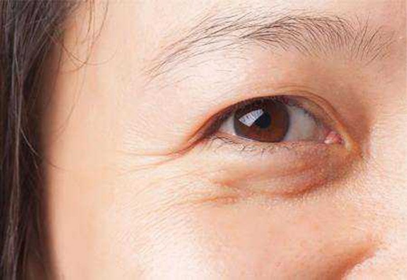 kem dưỡng da vùng mắt