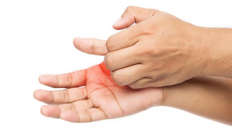 25 nguyên nhân gây ngứa ran ở tay và chân