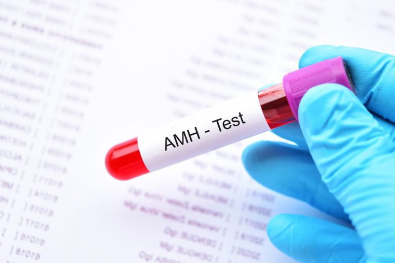 Chỉ số AMH 6,73 có phải bị buồng trứng đa nang không?