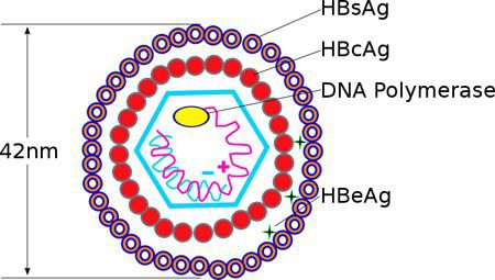 HBV tải lượng: 2,79x10^8 IU/mL, HBeAb (-), HBeAg (+), men gan bình thường là viêm gan B cấp tính hay mạn tính?