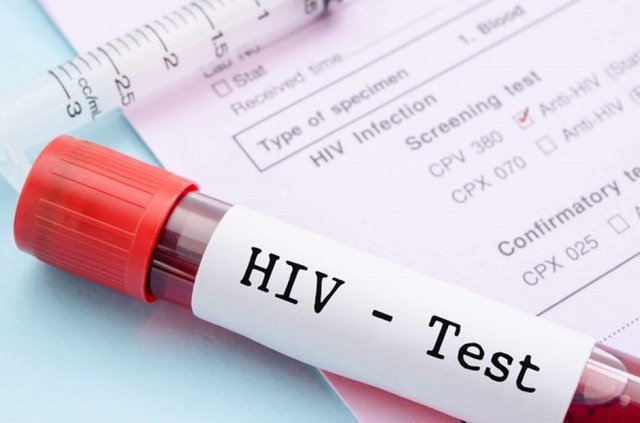 Xét nghiệm máu nhanh cho kết quả HIV khi mang thai có phải nhiễm HIV không?