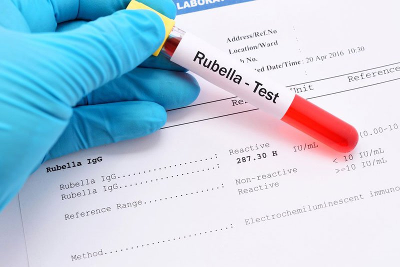 xét nghiệm rubella trong thai kỳ