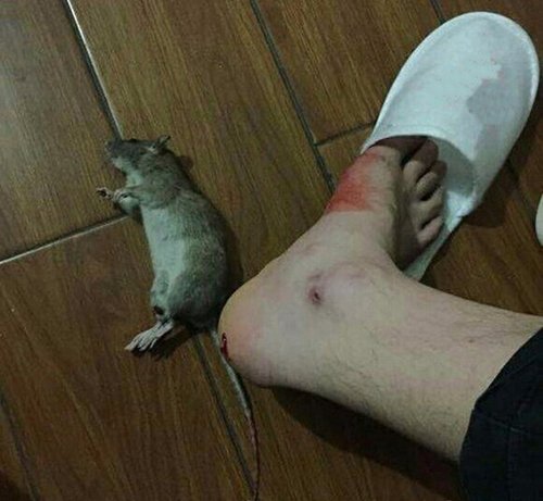 Gần gót chân bị chuột cắn có sao không?