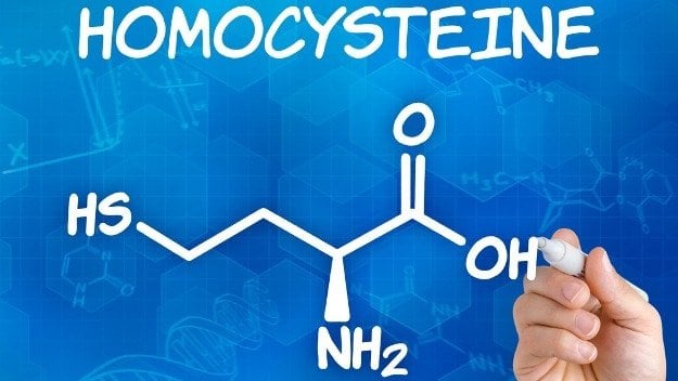 Xét nghiệm Homocysteine