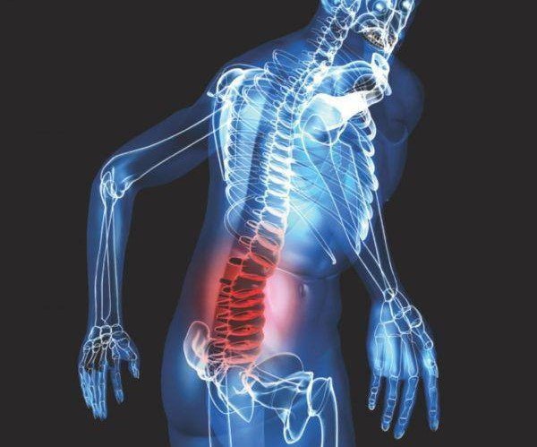Đau lưng, đau nhức đùi có phải dấu hiệu ung thư xương không?