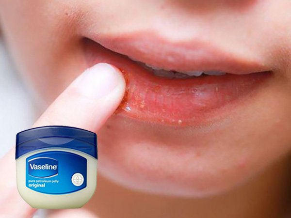 Có nên dùng Vaseline bôi môi?