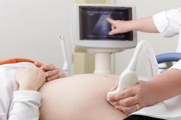 Mang thai 21 tuần có chỉ số siêu âm động mạch rốn cao có sao không?