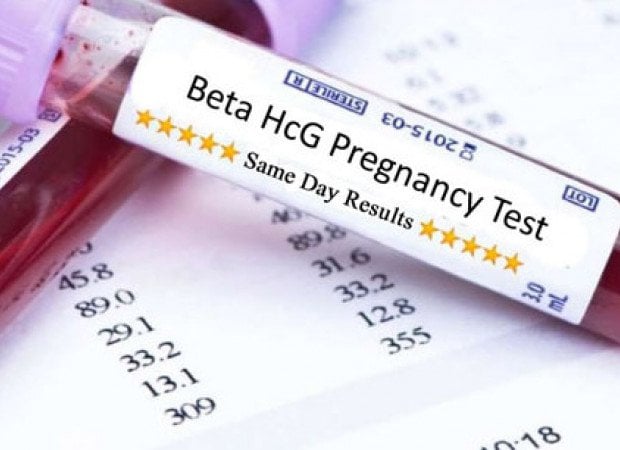 Kết quả xét nghiệm máu beta giảm có phải sảy thai không?