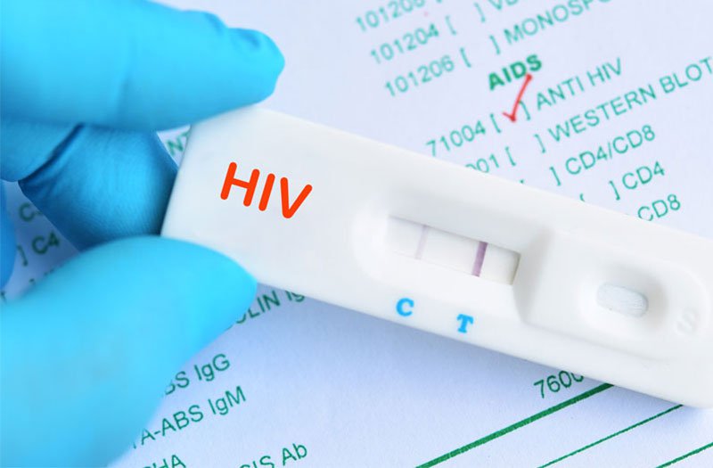 Kết quả phản ứng HIV 1,14 khi xét nghiệm HIV có sao không?