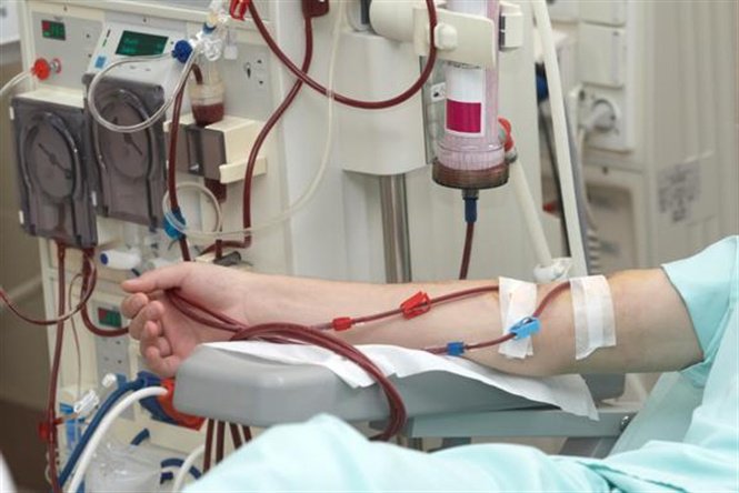 Bệnh nhân chạy thận 5 năm, lắng đọng canxi máu có ghép thận được không?