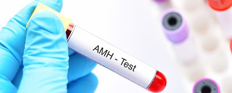Kết quả xét nghiệm AMH