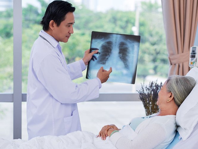 Điều trị viêm phổi