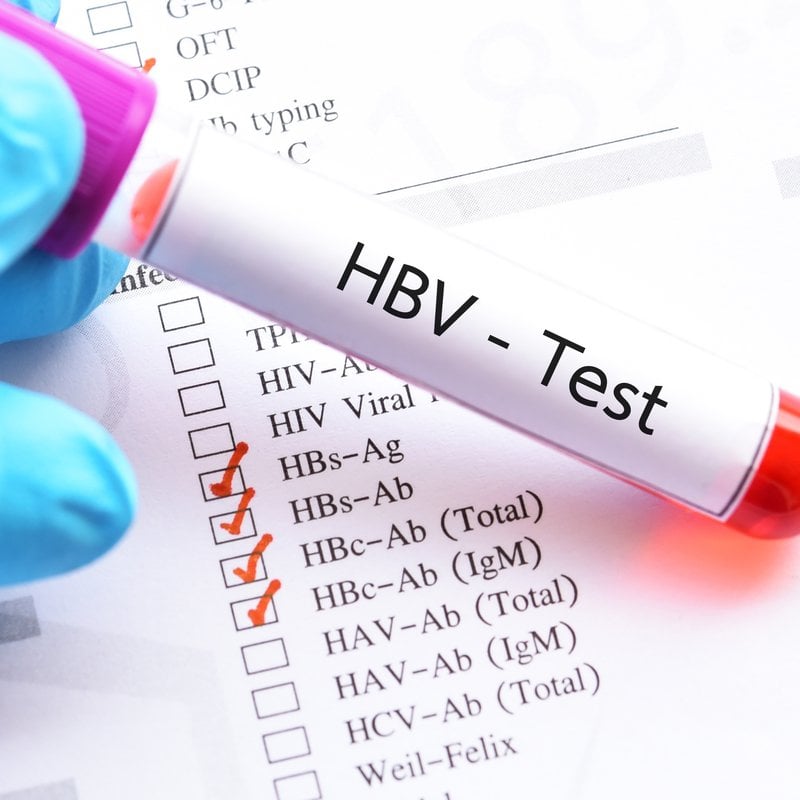 Chỉ số xét nghiệm virus viêm gan B như nào là cao nhất?