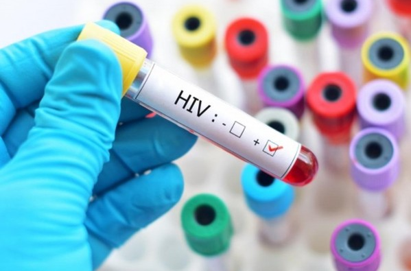 Kết quả xét nghiệm HIV dương tính là do đâu?
