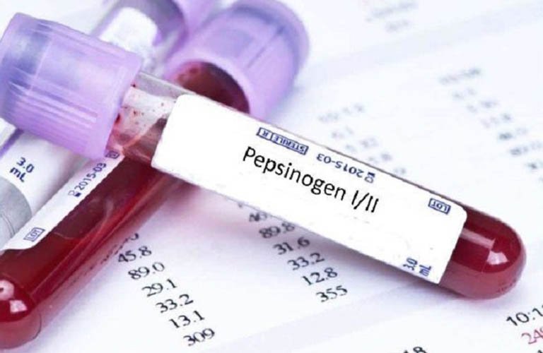 Xét nghiệm Pepsinogen như thế nào là nguy hiểm?