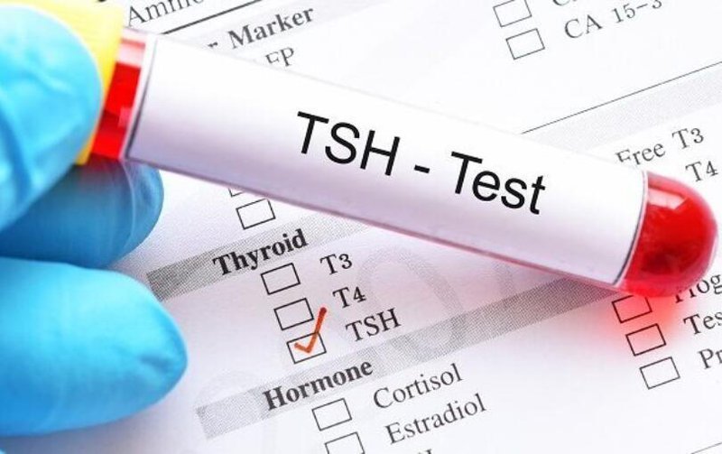 Chỉ số TSH giảm có phải là dấu hiệu của bệnh tuyến giáp không?