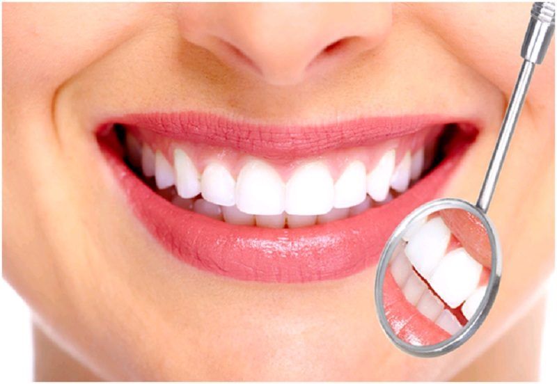 bọc răng sứ giữ được bao lâu