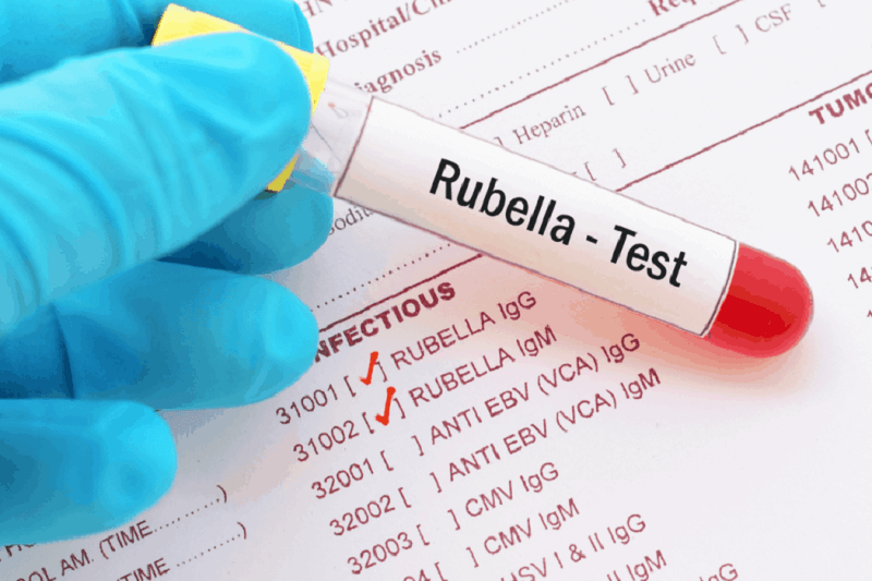 Chỉ số Rubella IgG dương tính 2.05 và Rubella IgG âm tính 0.1 trong xét nghiệm máu có nghĩa gì?