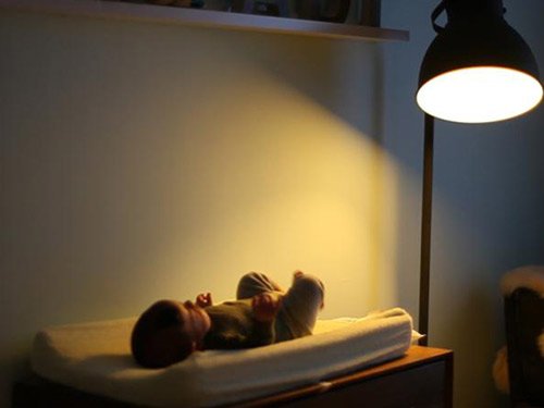 Khi nào cần bật đèn tuýp cho trẻ sơ sinh để tránh vàng da