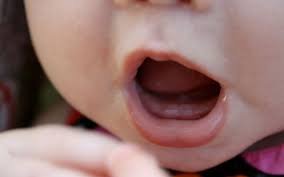 Trẻ 6 tháng tuổi bị rụng răng có nguy hiểm không?