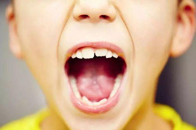 Một số loại nước ép trái cây có thể làm hỏng men răng