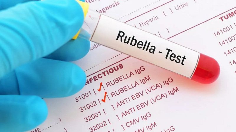 Kháng thể virus Rubella 61 nghĩa là gì và có nguy hiểm không?