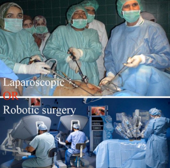 phẫu thuật robot