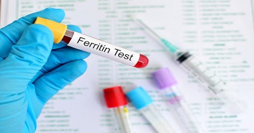 Định lượng Ferritin và acid uric trong máu có liên quan đến nhau không?