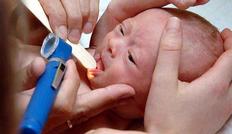 Trẻ sơ sinh bị viêm mũi họng cấp chăm sóc mũi họng như thế nào?