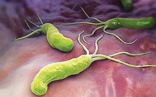 vi khuẩn h. pylori
