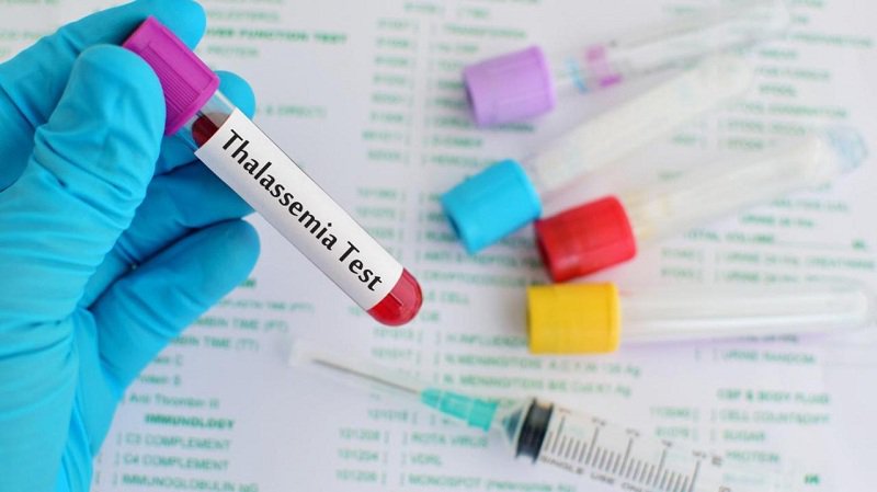 Xét nghiệm Thalassemia