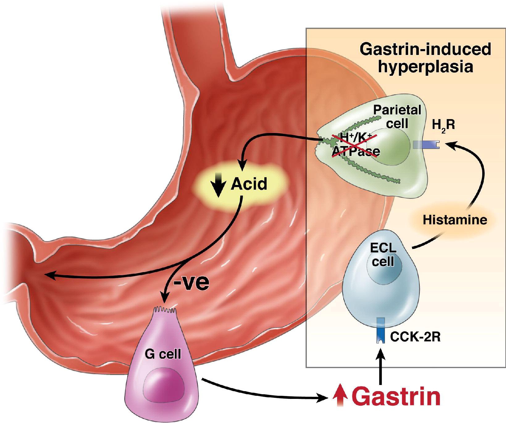 Hormone Gastrin