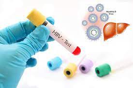 Kết quả xét nghiệm chẩn đoán nhiễm viêm gan B thì phải làm sao?