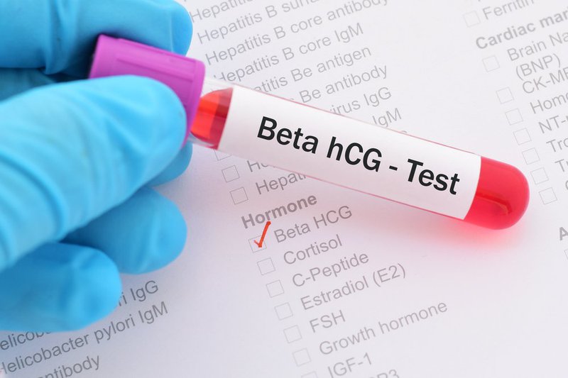 Nồng độ beta HCG có bị ảnh hưởng sau hút thai trứng không?