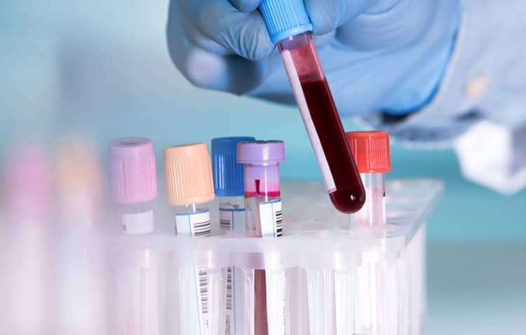 Xét nghiệm máu có chẩn đoán được nhiễm viêm gan B, C, HIV không?