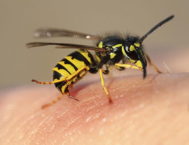 Nổi hạch sau khi bị ong đốt nên làm gì?