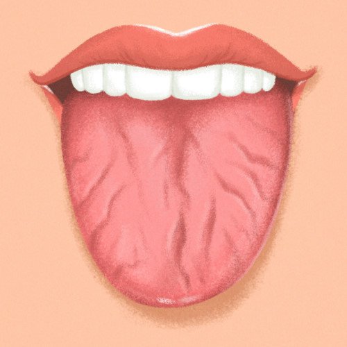 Lưỡi bị nứt và nổi nốt là do bệnh gì?