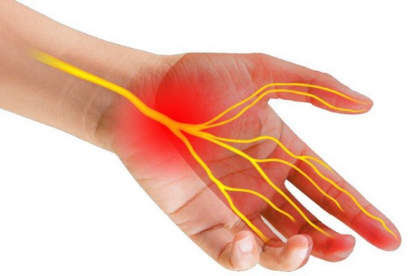 Đau cổ tay phía ngón út là dấu hiệu của bệnh gì?