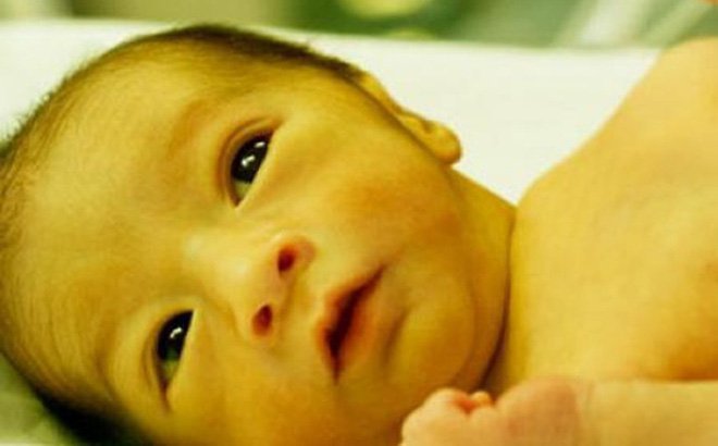 Trẻ sơ sinh bị vàng da có nguy hiểm không?