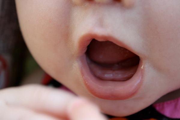 Trẻ bị sốt, biếng ăn khi mọc răng có nguy hiểm không?