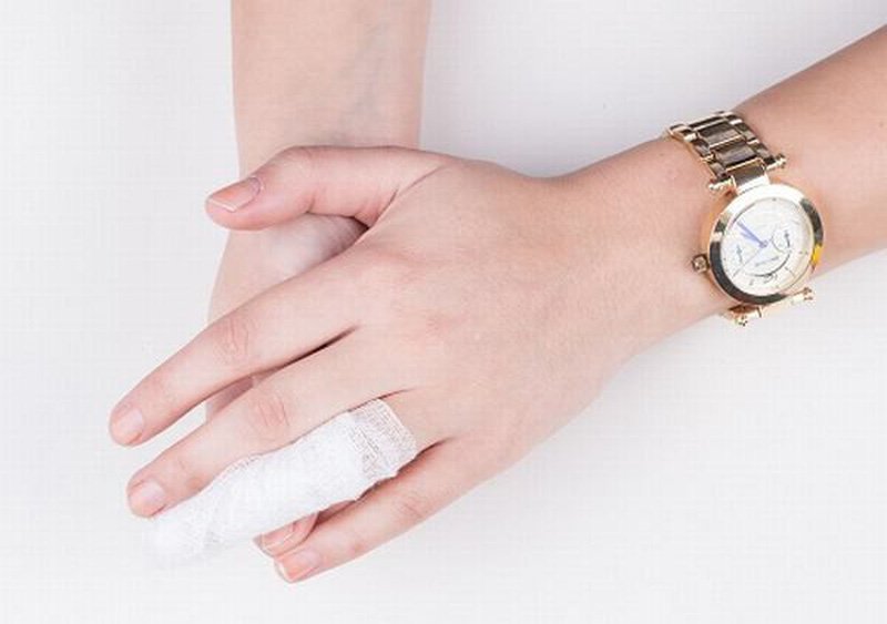 Sau khi mổ nối gân ngón tay có nên rửa vết thương không?