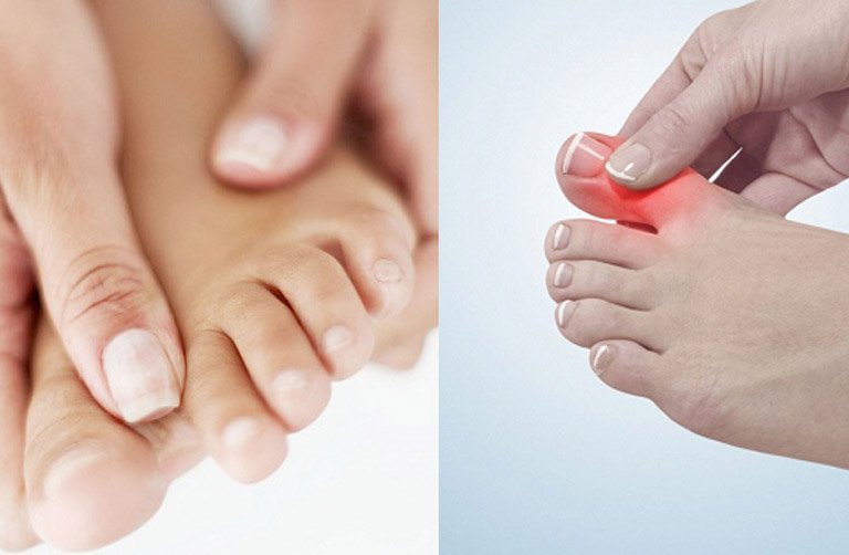 Nữ giới đau nhức, co thắt ngón chân điều trị như thế nào?