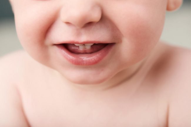trẻ mọc thiếu răng sữa