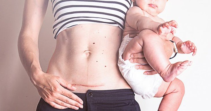 Mang thai lần hai sau sinh con 9 tháng có nguy cơ gì không?