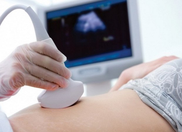Kết quả siêu âm có một túi ối kích 4mm liệu đã mang thai chưa?