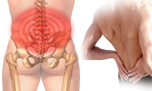 Đau lưng, đau hai bên mông kéo dài 2-3 tháng là bị làm sao?
